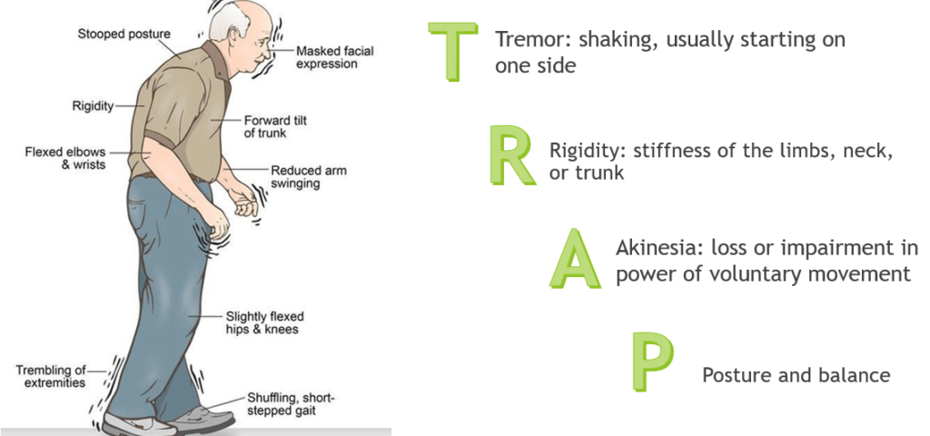 مشکلات حرکتی در بیماران پارکینسون