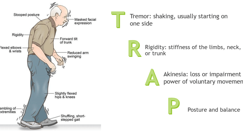مشکلات حرکتی در بیماران پارکینسون